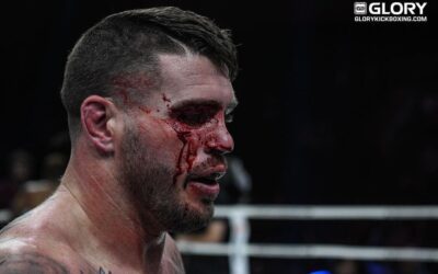 Almost time for the return of Chris Camozzi